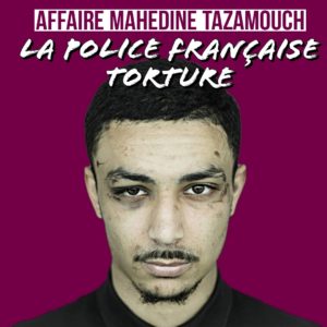 francia polizia torture